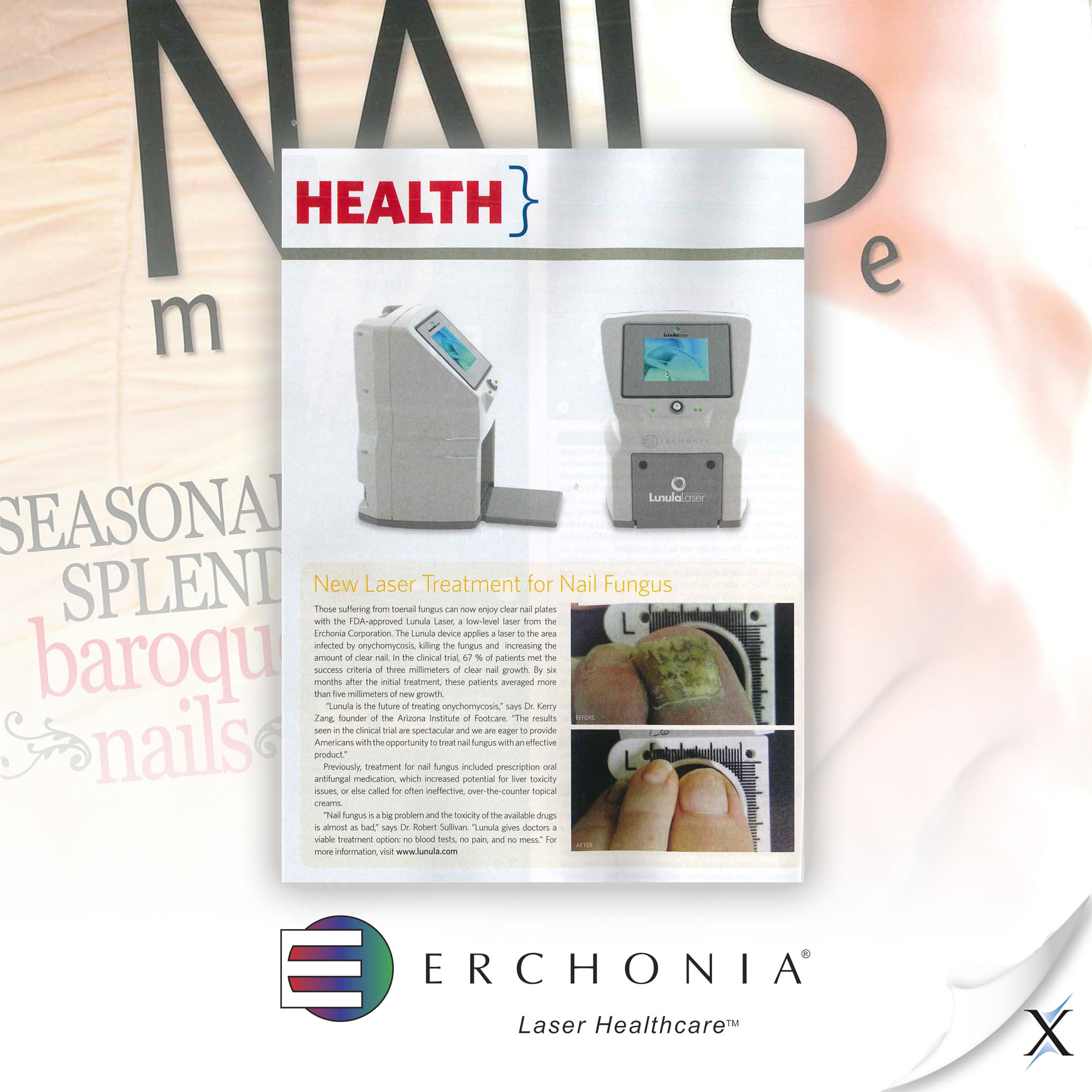 More than 141M media impressions for laser healthcare company